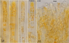 Ramsbottomia asperior