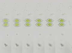 Staurastrum aciculiferum