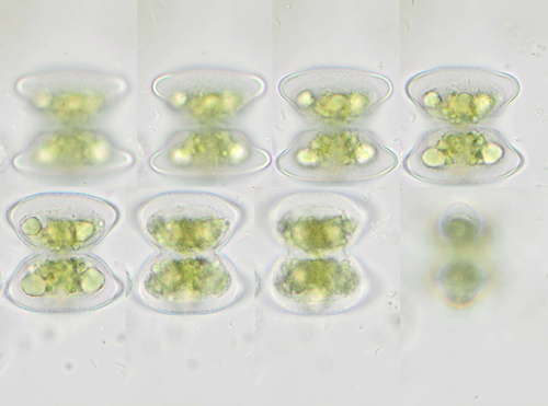 Staurastrum pachyrhynchum