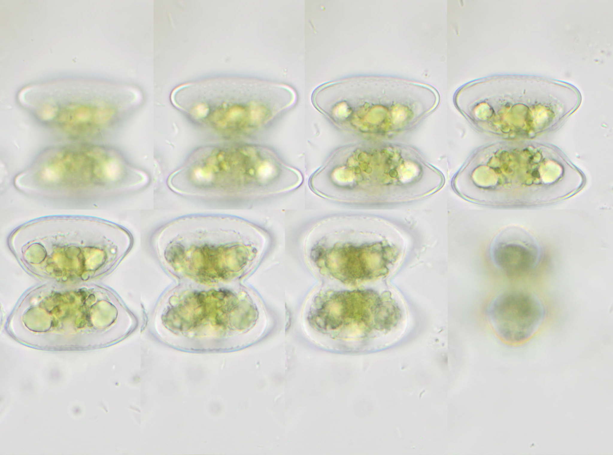 Staurastrum pachyrhynchum