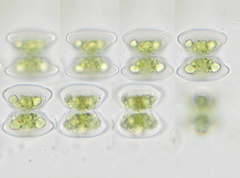 Staurastrum pachyrhynchum