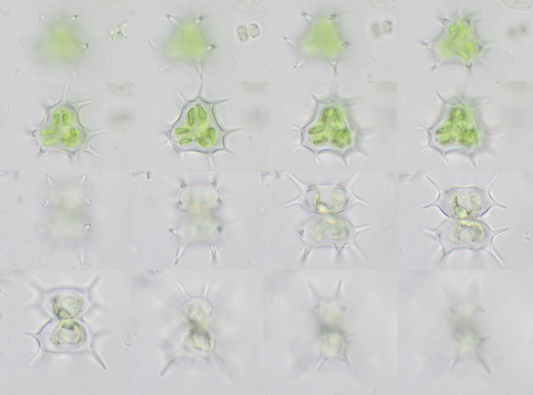 Staurastrum quadrispinatum