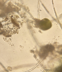 Climacostomum virens