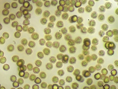 Reticularia jurana