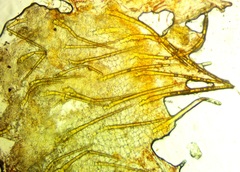 Cheilymenia stercorea