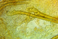 Cheilymenia stercorea