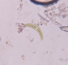 Closterium leibleinii