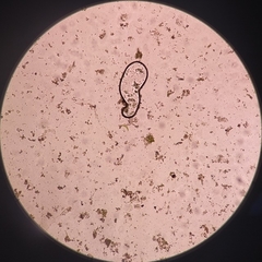 Closterium leibleinii