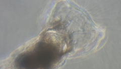 Collotheca