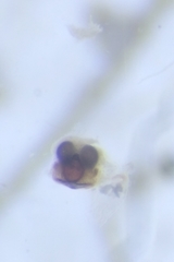 Theridion varians