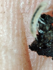 Miktoniscus bisetosus