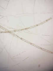 Spirogyra