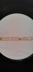 Spirogyra