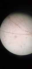 Spirogyra