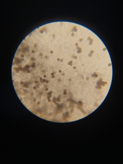 Physarum diderma
