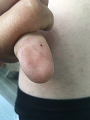 Amblyomma americanum