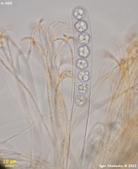 Pulvinula convexella