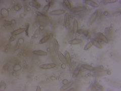 Leccinum flavostipitatum