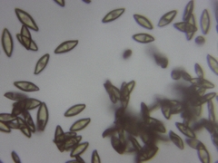 Leccinum flavostipitatum