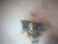 Plagiolepis