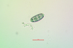 Buellia oidalea