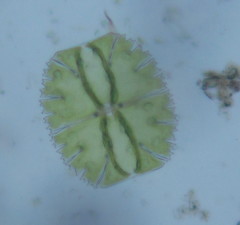 Micrasterias truncata