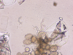 Peronospora variabilis