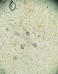 Candolleomyces candolleanus