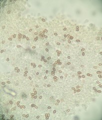 Candolleomyces candolleanus