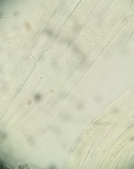 Candolleomyces candolleanus