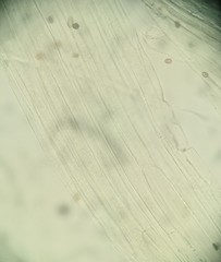 Candolleomyces candolleanus