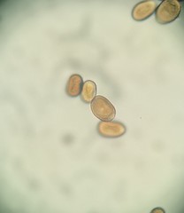 Puccinia phellopteri