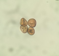 Puccinia calystegiae-soldanellae