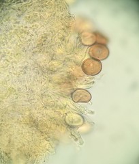 Puccinia calystegiae-soldanellae