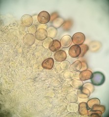 Puccinia calystegiae-soldanellae