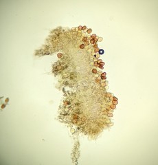 Puccinia calystegiae-soldanellae