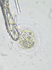 Cochliopodium