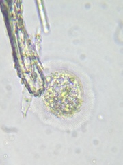 Cochliopodium
