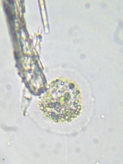 Cochliopodium