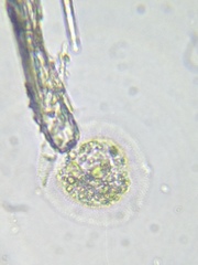 Cochliopodium