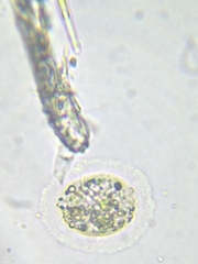 Cochliopodium