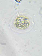Cochliopodium