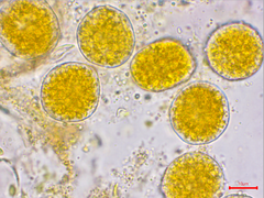Puccinia symphyti-bromorum