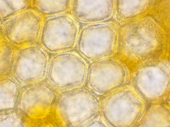Puccinia symphyti-bromorum
