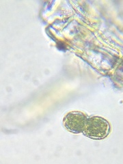 Cosmarium contractum