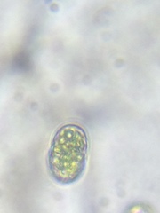 Actinotaenium curtum