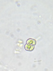 Cosmarium contractum