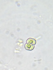 Cosmarium contractum