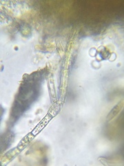 Rhizoclonium
