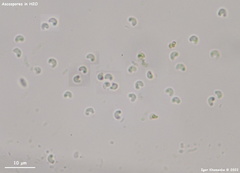 Orbilia xanthostigma